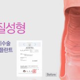 더블반영구 질성형