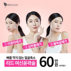 얼굴지방흡입 60