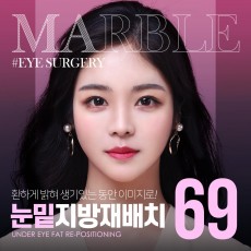 눈밑지방재배치
