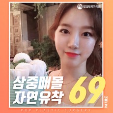 쓰리턴 자연유착 69