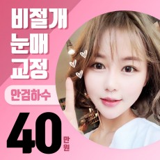 안검하수? 눈매교정! 40