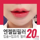 엔젤립필러 입술+입꼬리 필러