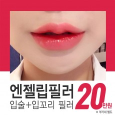 엔젤립필러 입술+입꼬리 필러